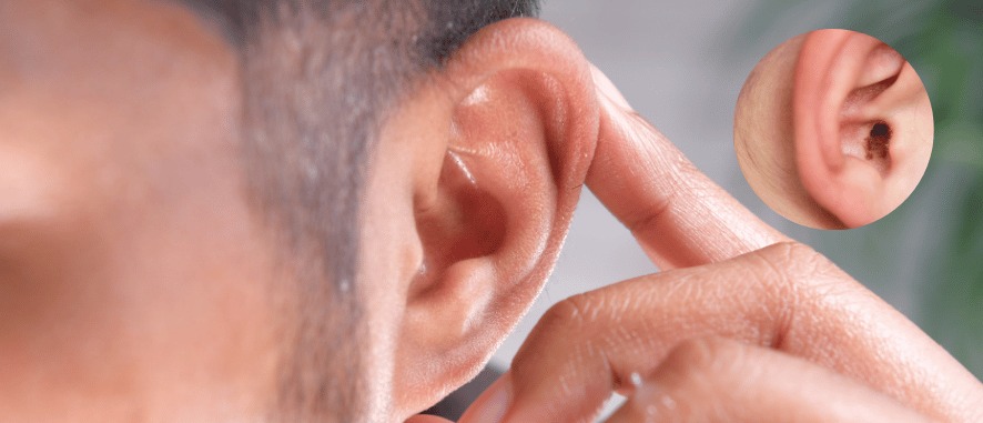 When Tinnitus Becomes a Warning Sign: Understanding When to Seek Help | Aanvii Hearing